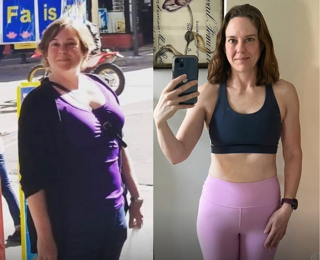 Before and After